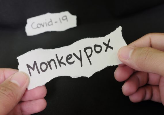 Key Differences between Monkeypox and COVID-19
