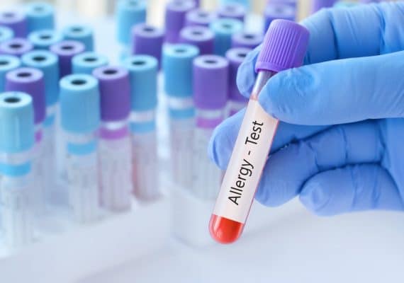 Allergy Testing - Miles Pharmacy